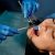 Periodontal Treatment