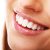 Teeth Whitening